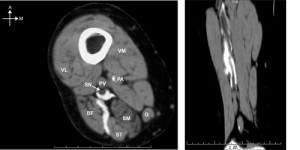 fig24-25