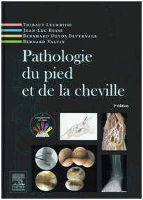 pathologie-du-pied