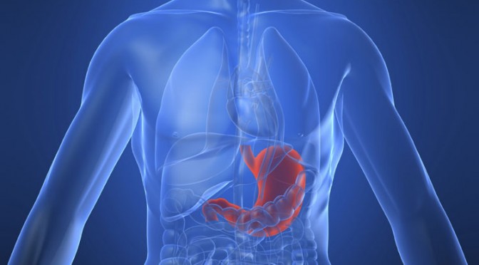 Stretta of de behandeling van gastro-oesofageale reflux door middel van radiofrequentie