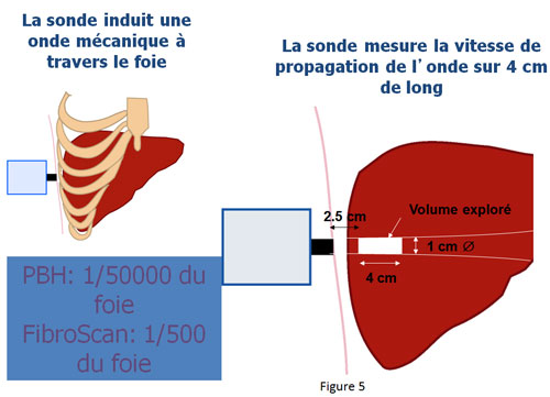 hepatitefig5