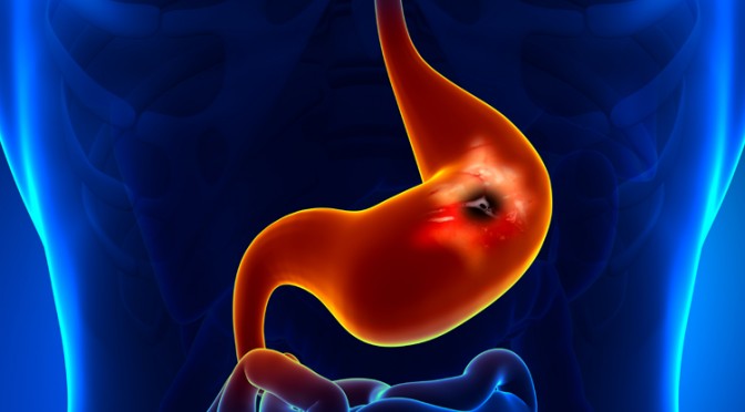 Gastro- entérologie : les derniers standards pour traiter l’ensemble des pathologies digestives