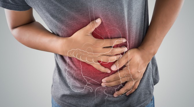 Overzicht van een vaak voorkomend syndroom: het prikkelbare-darmsyndroom (IBS)