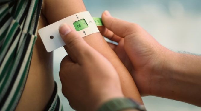 La dénutrition du patient hospitalisé est un problème majeur de santé publique, souvent sous-estimé et méconnu
