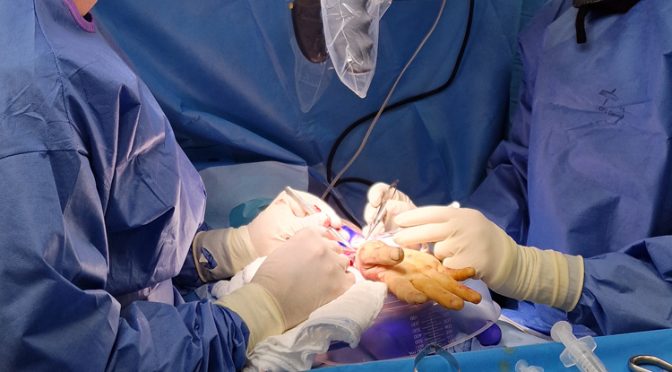 Réimplantations réussies d’une main et d’un doigt amputés au CHIREC grâce aux collaborations inter-hospitalières